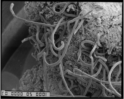 Graham_strongyle_nematode_400