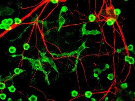 microglia_and_neurons