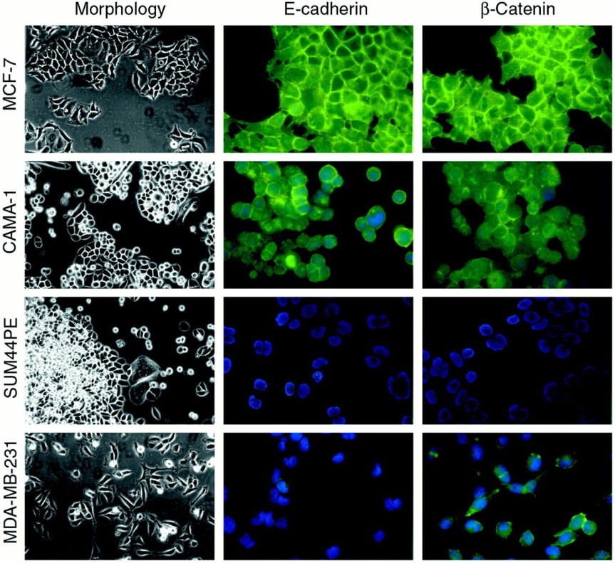 3/27/18 Show feat. Rebecca Elyanow on Gene Assembly and Tracking Cancer&nbsp;Mutations